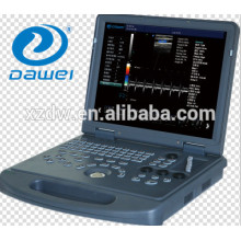 ultra-sonografia vascular com doppler e com doppler colorido de coração OB / GNY